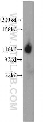 ICAM3 Antibody in Western Blot (WB)