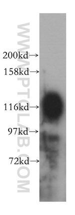 ICAM3 Antibody in Western Blot (WB)
