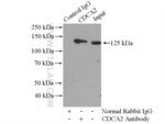 CDCA2 Antibody in Immunoprecipitation (IP)