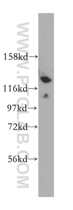 CDCA2 Antibody in Western Blot (WB)
