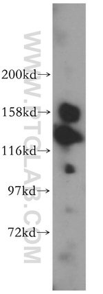 CDCA2 Antibody in Western Blot (WB)