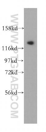 CDCA2 Antibody in Western Blot (WB)