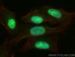 REV1 Antibody in Immunocytochemistry (ICC/IF)