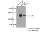 USP28 Antibody in Immunoprecipitation (IP)