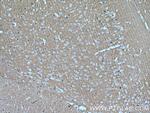 MPP5 Antibody in Immunohistochemistry (Paraffin) (IHC (P))