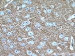 MPP5 Antibody in Immunohistochemistry (Paraffin) (IHC (P))