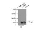 MPP5 Antibody in Immunoprecipitation (IP)