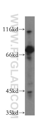 MPP5 Antibody in Western Blot (WB)