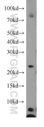 ARFRP1 Antibody in Western Blot (WB)