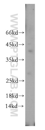 ULBP1 Antibody in Western Blot (WB)