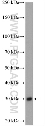 ULBP1 Antibody in Western Blot (WB)