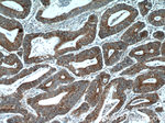 EB1 Antibody in Immunohistochemistry (Paraffin) (IHC (P))