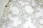 EB1 Antibody in Immunohistochemistry (Paraffin) (IHC (P))