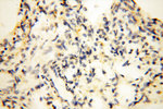 EB1 Antibody in Immunohistochemistry (Paraffin) (IHC (P))