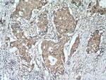 P5CS Antibody in Immunohistochemistry (Paraffin) (IHC (P))