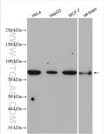 P5CS Antibody in Western Blot (WB)