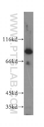 P5CS Antibody in Western Blot (WB)