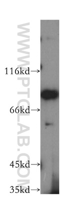 P5CS Antibody in Western Blot (WB)