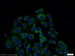CSK Antibody in Immunocytochemistry (ICC/IF)