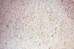 CSK Antibody in Immunohistochemistry (Paraffin) (IHC (P))