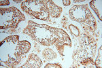 CSK Antibody in Immunohistochemistry (Paraffin) (IHC (P))