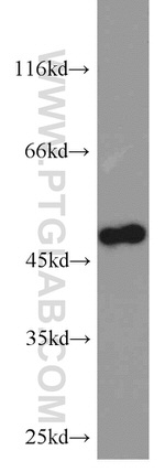 CSK Antibody in Western Blot (WB)