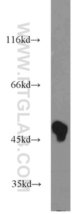 CSK Antibody in Western Blot (WB)