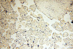 SMARCC1 Antibody in Immunohistochemistry (Paraffin) (IHC (P))