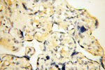 SMARCC1 Antibody in Immunohistochemistry (Paraffin) (IHC (P))