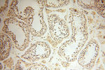 SMARCC1 Antibody in Immunohistochemistry (Paraffin) (IHC (P))