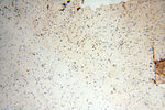 SMARCC1 Antibody in Immunohistochemistry (Paraffin) (IHC (P))