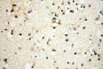 SMARCC1 Antibody in Immunohistochemistry (Paraffin) (IHC (P))