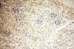 SMARCC1 Antibody in Immunohistochemistry (Paraffin) (IHC (P))