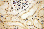 SMARCC1 Antibody in Immunohistochemistry (Paraffin) (IHC (P))
