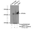 SMARCC1 Antibody in Immunoprecipitation (IP)