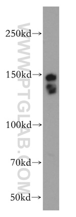 SMARCC1 Antibody in Western Blot (WB)