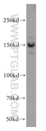 SMARCC1 Antibody in Western Blot (WB)