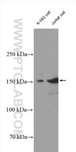 SMARCC1 Antibody in Western Blot (WB)