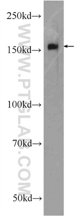 SMARCC1 Antibody in Western Blot (WB)