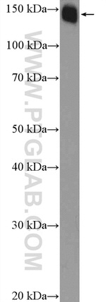 SMARCC1 Antibody in Western Blot (WB)