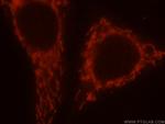 SAMD4B Antibody in Immunocytochemistry (ICC/IF)