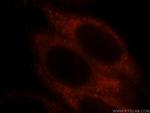 PRX5 Antibody in Immunocytochemistry (ICC/IF)