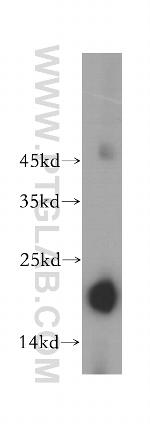 PRX5 Antibody in Western Blot (WB)