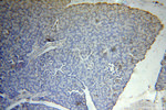 ARFIP1 Antibody in Immunohistochemistry (Paraffin) (IHC (P))
