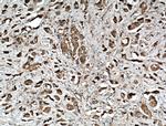 ARFIP1 Antibody in Immunohistochemistry (Paraffin) (IHC (P))