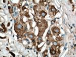 ARFIP1 Antibody in Immunohistochemistry (Paraffin) (IHC (P))