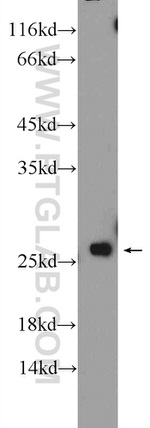 BLVRB Antibody in Western Blot (WB)