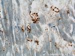 BLVRB Antibody in Immunohistochemistry (Paraffin) (IHC (P))