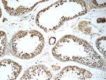 TSNAXIP1 Antibody in Immunohistochemistry (Paraffin) (IHC (P))