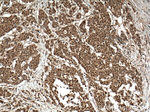 ENOPH1 Antibody in Immunohistochemistry (Paraffin) (IHC (P))